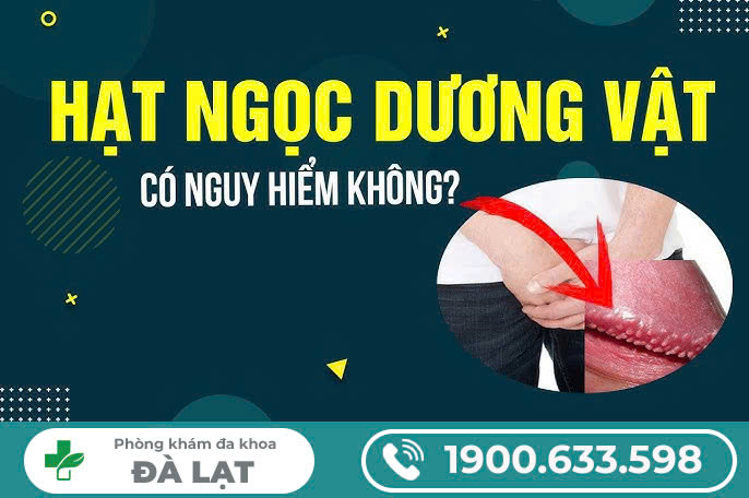 Hình ảnh minh họa